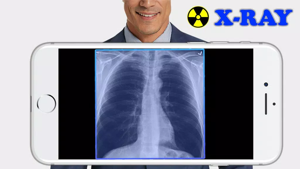 X-Ray Filter Photo ภาพหน้าจอ 1