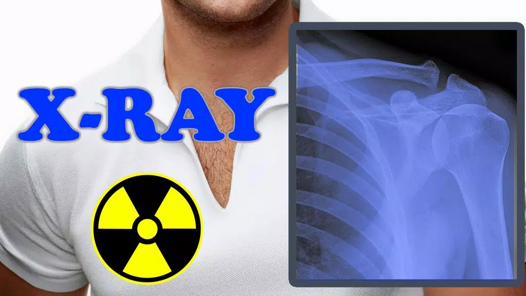 X-Ray Filter Photo ภาพหน้าจอ 3